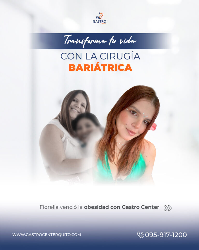 antes-después 4