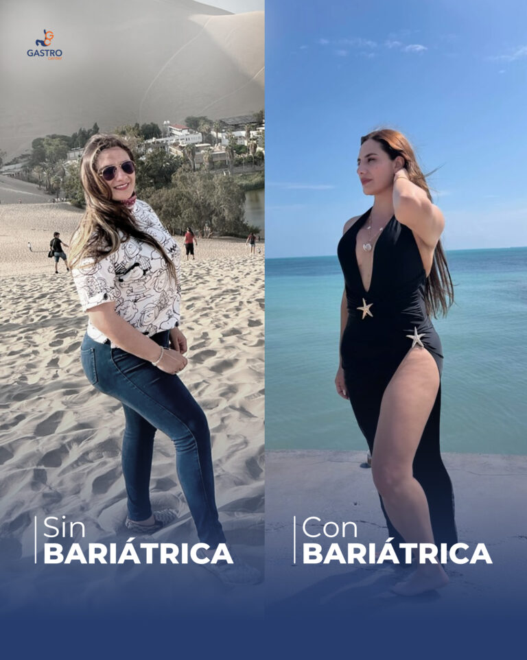 antes-después 5